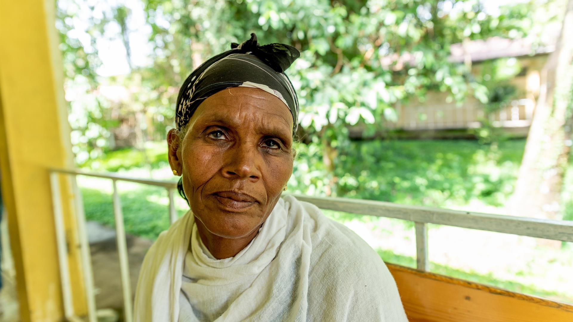 1 CBM Italia Mulu Affetta Da Tracoma Etiopia
